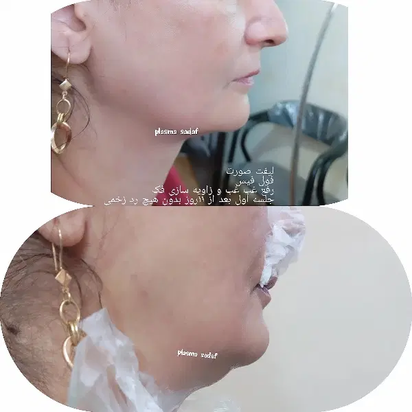 اجاره خانه سوییت ویلایی اتاق