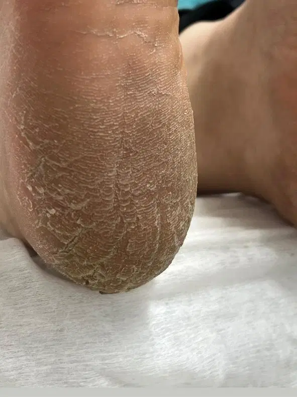 اجاره لاین پدیکور