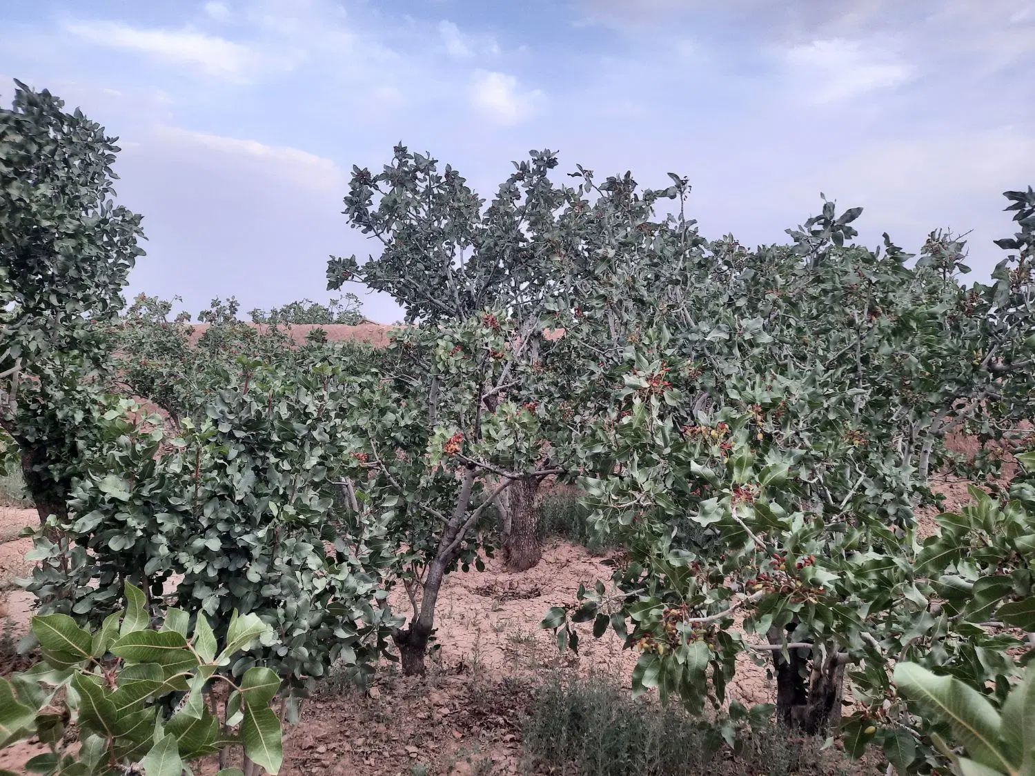 باغ پسته اقتصادی